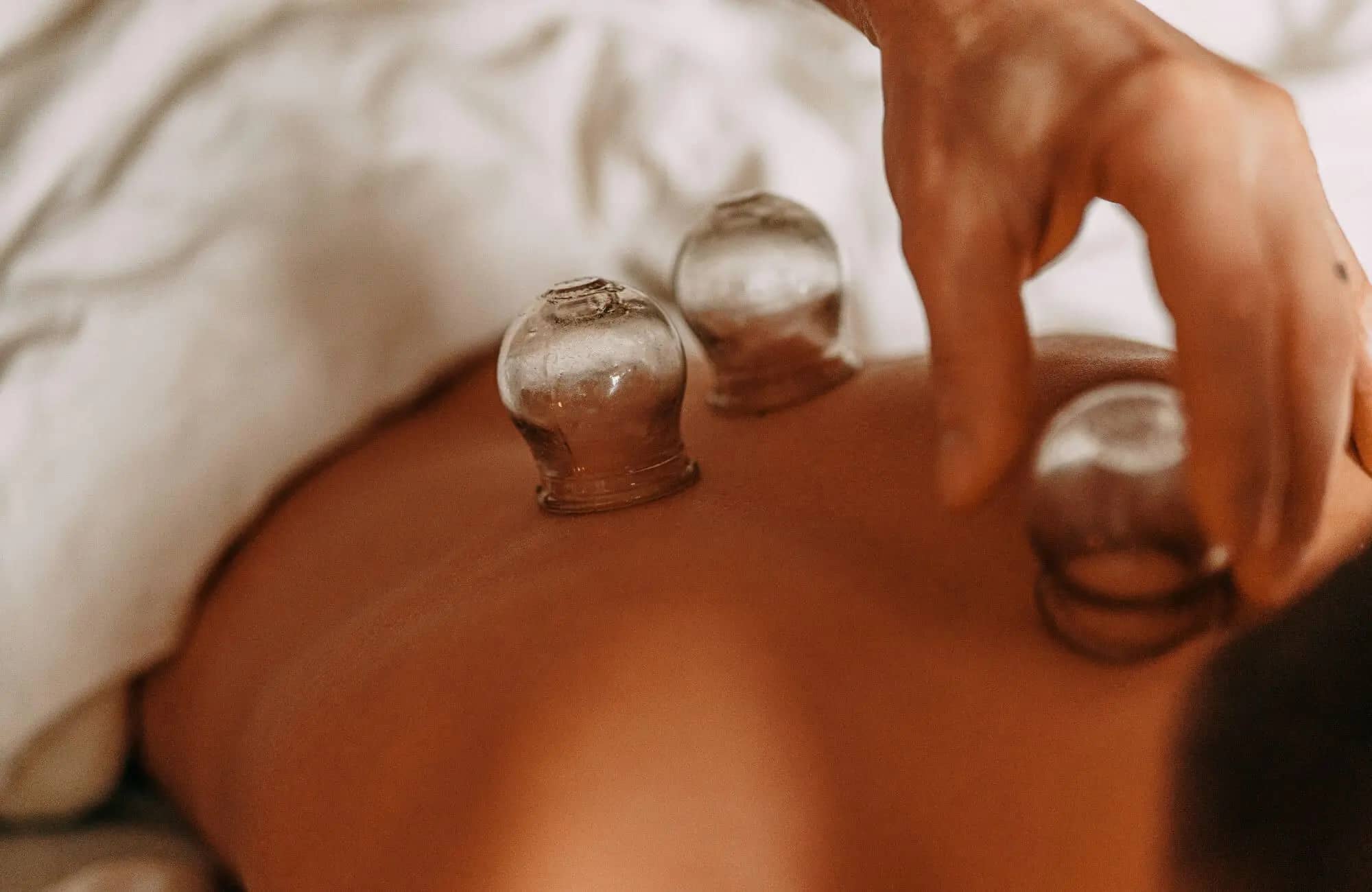 Sports injuries and muscle recovery Therapeutic cupping for sports injury recovery and muscle support